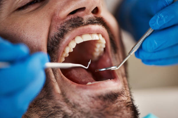 Professional Emergency Dental Service in CO
